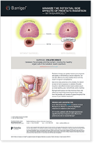 Barrigel Anatomy Chart